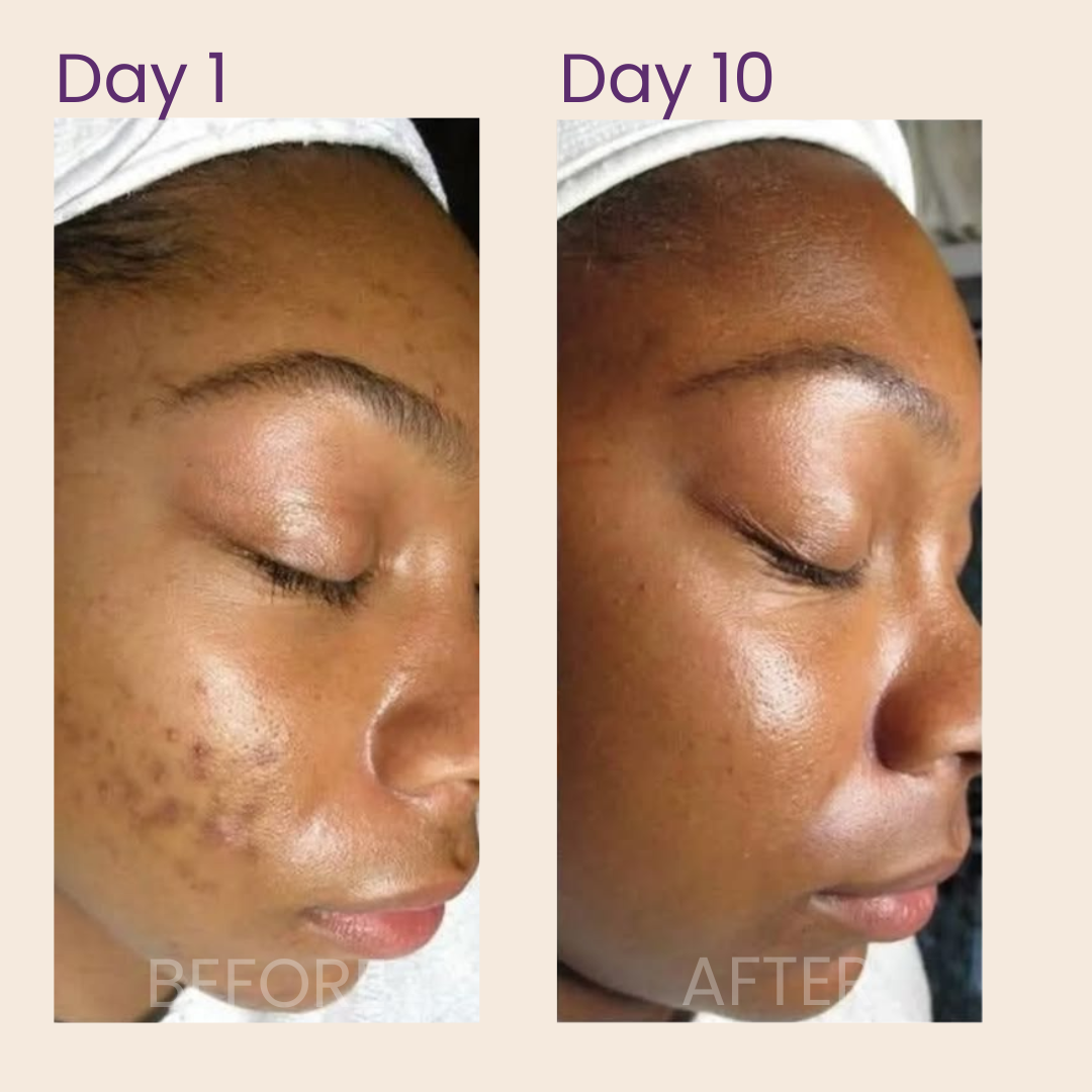 Clarity Toner Pads