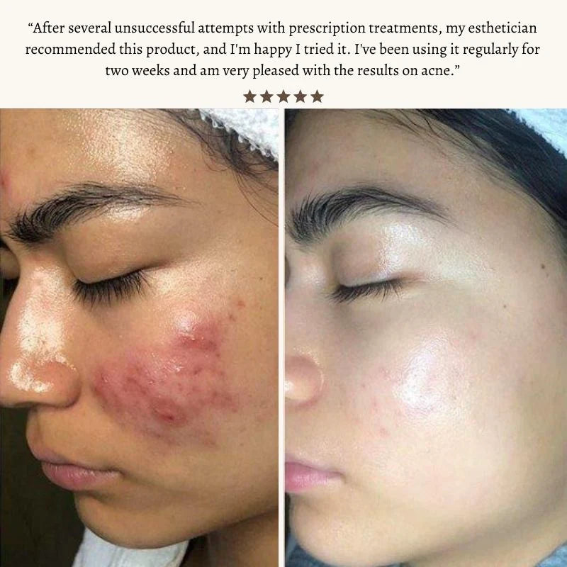 Elaroi Radiance Wand™