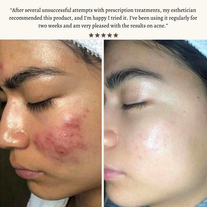 Elaroi Radiance Wand™